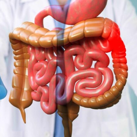 Doenças Intestinais Inflamatórias, quais os tratamentos possíveis?